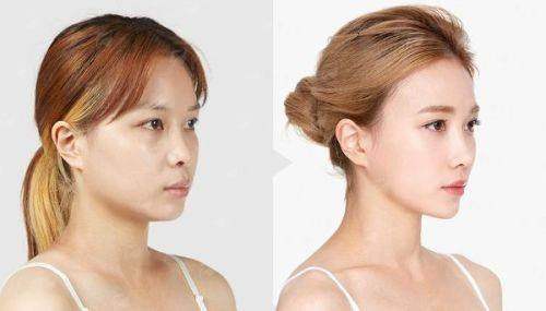 四、芜湖名姝医疗美容如何预约?附到院地址!