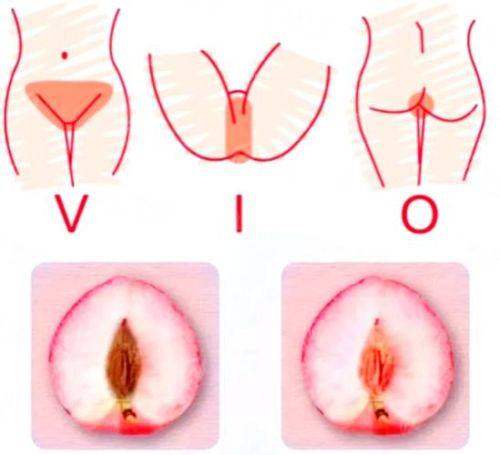 三、成都密爱天使处女膜修复术前术后要注意啥?