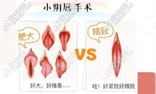 四、济南诺德张冠勋私密整形怎么预约？