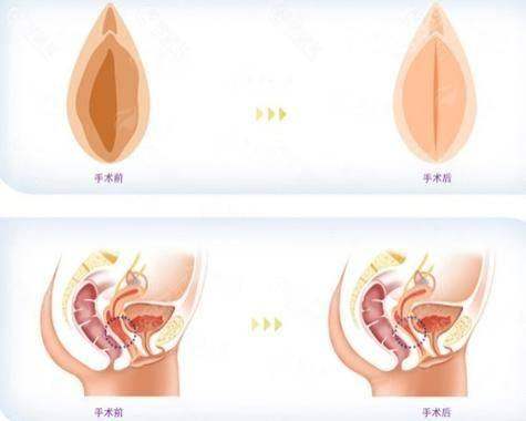 三、中山璞菲医美秘密年轻化的医生技术怎么样?
