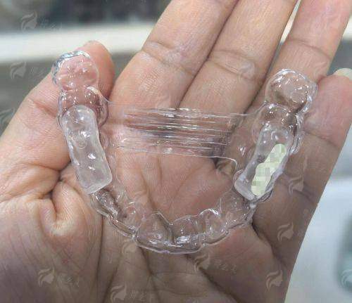 二、兰州润玉口腔隐形矫正要花多少钱？