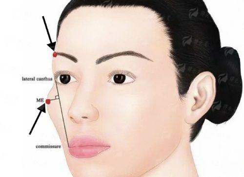 四、郑州梨花雨医院拉皮手术怎么预约?同城比价攻略