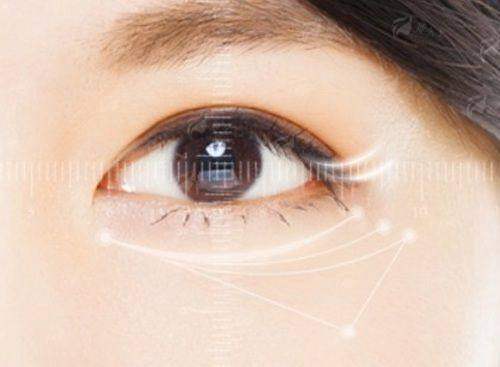 四、青海西宁韩美祛眼袋价格及预约方式