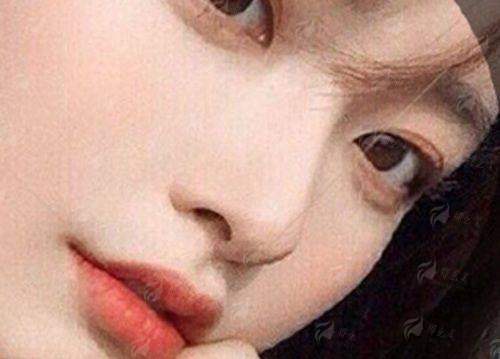 一、温州艺星隆鼻价格合适吗？先看两位医生硬核背景