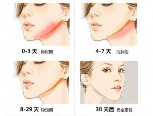 五、杭州清锴医疗美容门诊部术后护理体系