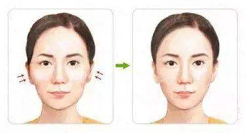 五、杭州清锴医疗美容门诊部肋骨隆鼻价格参考