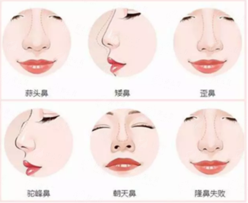 二、杭州清锴医疗美容门诊部李保锴医生的技术手法解析