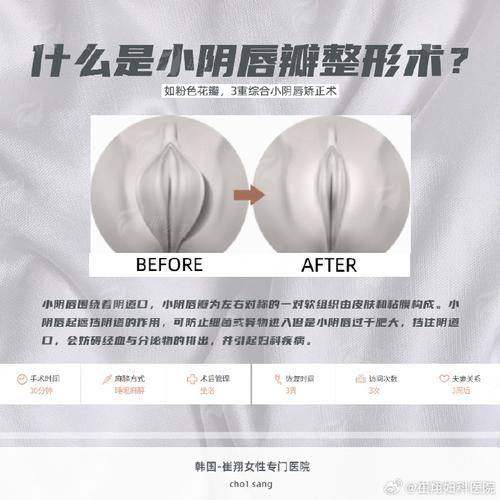 三、广西北海华美私密整形价格贵不贵？对比北海市场