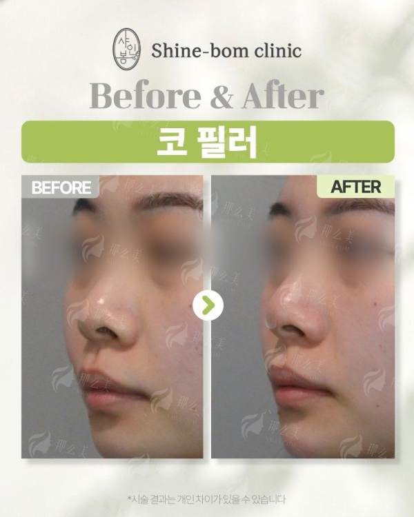 想了解杭州清锴李保锴医生技术手法怎么样？附坐诊地址和24小时预约挂号通道！