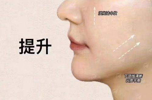 40岁做针孔式面部提升还来得及吗？池州容妍医疗专家解答+到院指南！