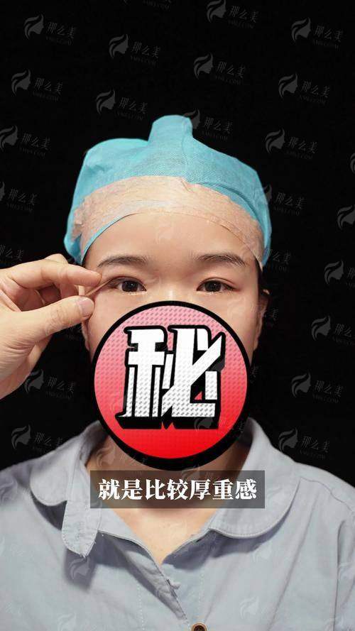 四、长沙亚韩徐敬宾双眼皮怎么预约更省心?