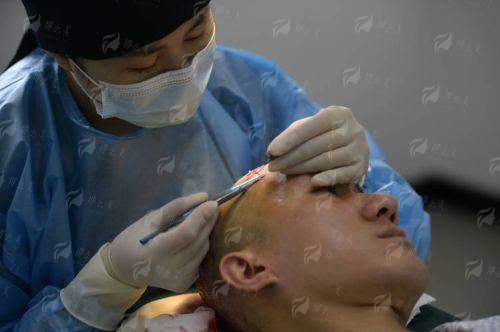 三、厦门新禾曙光植发不剃发植发价格贵不贵？