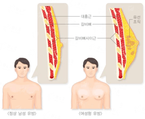 <strong>四、南通星小范医疗美容门诊部肋骨隆鼻术后护理要点</strong>