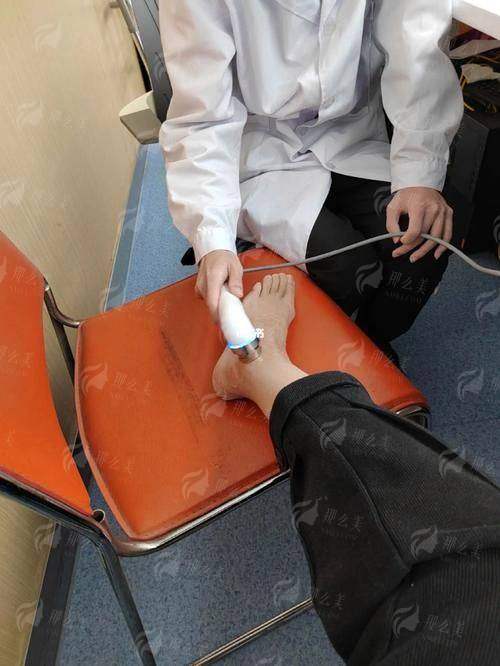 半岛超声炮杭州哪家好？至优美医疗美容真实案例+价格全公开，看完再决定！