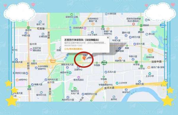 四、深圳艺星双眼皮手术的修复期和术后成效真实反馈