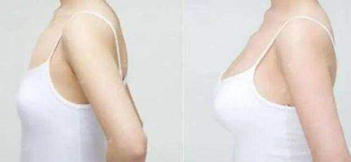 遵义韩美丰胸选姜晓珍医生值不值？技术对比+案例分享，预约方式全指南！