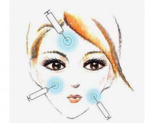 <strong>四、北京薇琳医疗美容医院真实实例见证</strong>