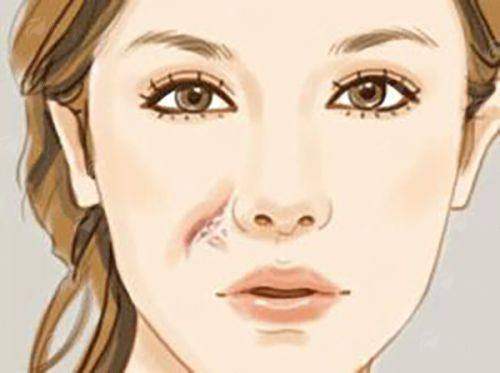 <strong>四、北京薇琳医疗美容医院史浩北拉皮手术真实实例分享</strong>