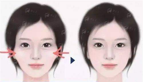 <strong>四、北京薇琳医疗美容医院安心保护体系</strong>