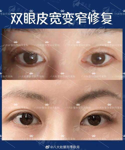 六、上海艺星医疗美容医院（长宁院）选择建议