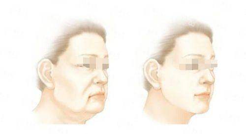 五、深圳米兰柏羽医疗美容医院服务流程规范