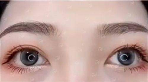 好奇深圳米兰柏羽黄显翔案例可靠不？案例了解+价格分析，赶紧预约挂号！