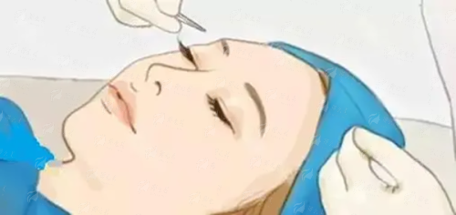 六、深圳米兰柏羽医疗美容医院项目价格参考