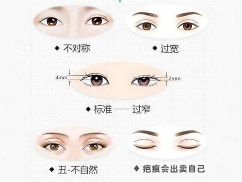 想知道深圳米兰柏羽付蓉案例靠不靠谱？全解析在此，核心技术优势详解！附24小时预约通道！