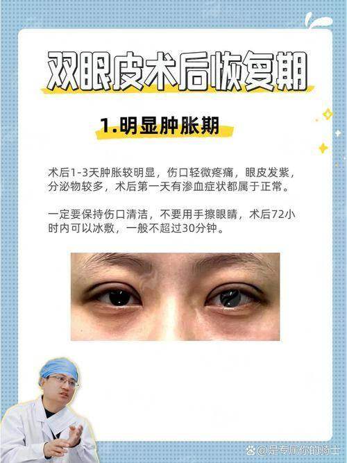 三、广州曙光阮庆玲医生双眼皮价格大揭秘