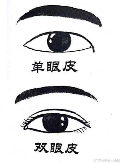 二、广州曙光阮庆玲医生双眼皮真人实例大公开