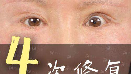 二、北京客来美舍张冰洁眼修复价格贵吗？2026全新收费