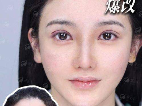 北京客来美舍张冰洁眼修复价格贵吗？2026最新收费分析，附医院地址！