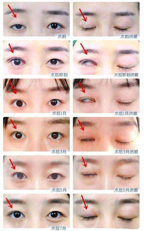 六、为什么选择上海艺星医疗美容医院（长宁院）彭才学医生