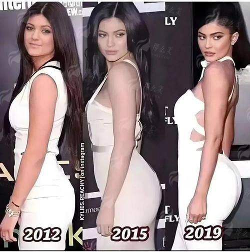 二、遵义韩美美容医院做丰胸有哪些优势？