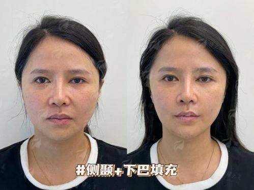 三、真人实例说话！填完被夸“悄悄变年轻”是什么体验