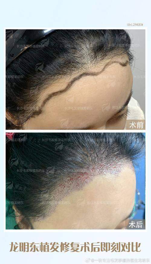 <strong>六、选择上海艺星医疗美容医院（长宁院）的理由</strong>