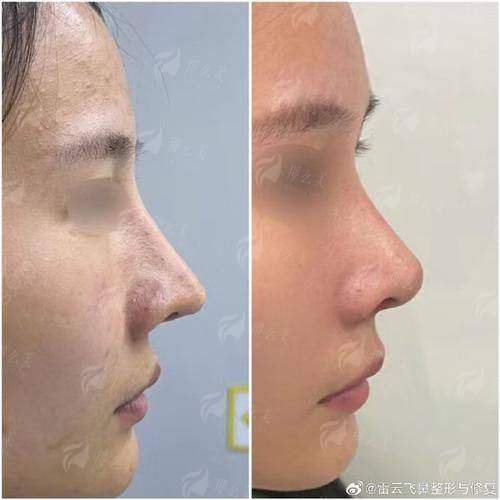 二、成都高新后美医院环境如何?专精团队保驾护航