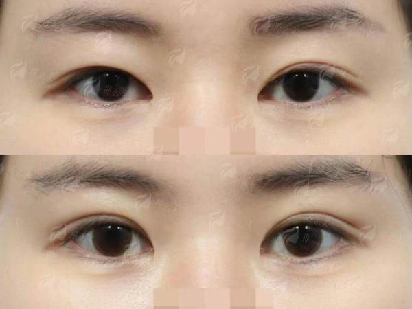 四、北京薇琳医疗美容医院个性化设计方案