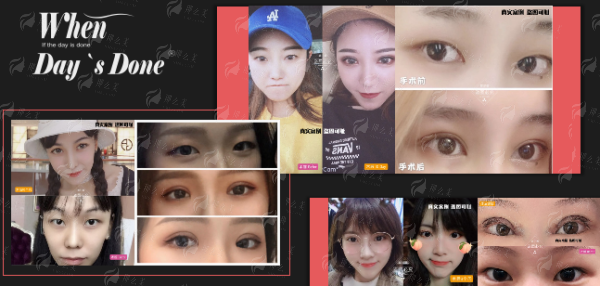 四、洛阳莱尔美整形医院预约攻略与术后护理