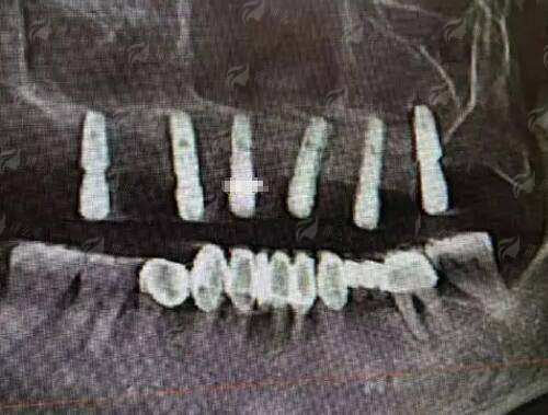 二、价格表曝光：国有医院的性价比真相