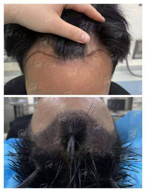 四、贵州黔南菲梵医美如何预约发际线种植？医院地址在哪？