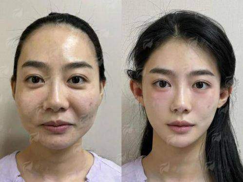 四、西安国内外预约李高峰面诊必看！3个关键问题