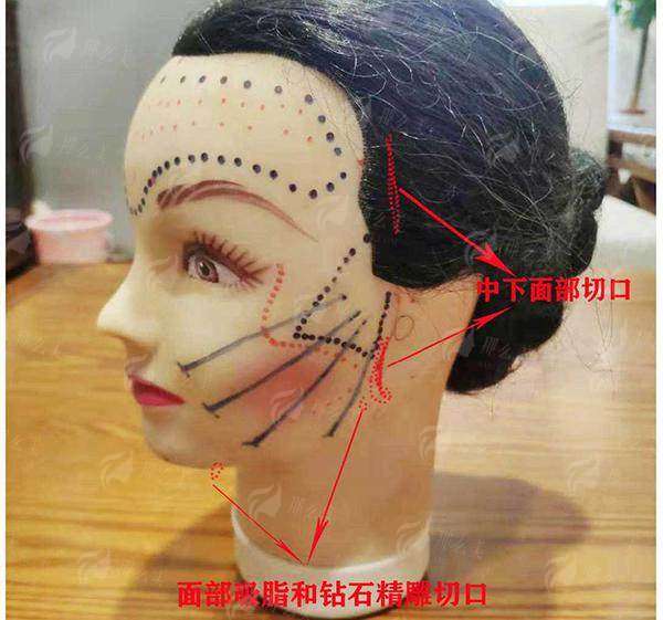 三、祛疤痕项目价格参考