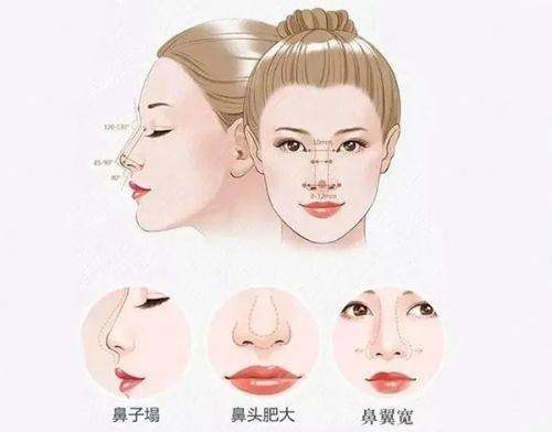 三、南通星小范医疗美容门诊部假体选择指南