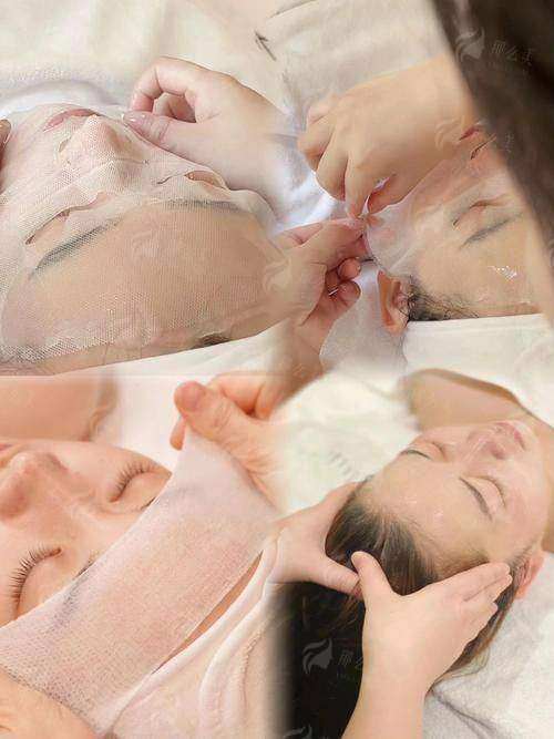 四、北京美丽之冠杨旭芳医生做五代热玛吉值不值得选？