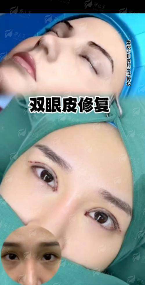 三、上海爱尚丽格医疗美容的眼修复有什么优势？