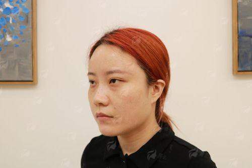 四、如何预约佀同帅眼修复？上海华美就诊指南