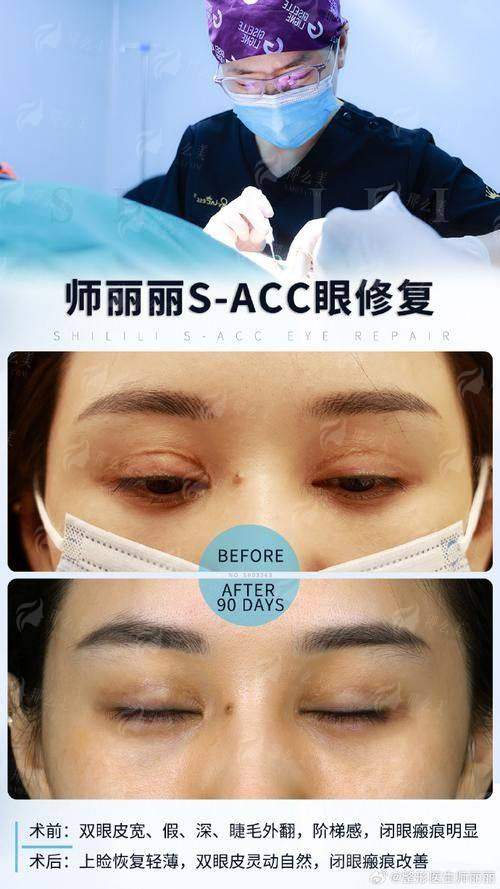 眼修复选哪家？上海爱尚丽格vs其他医院对比，看真实效果再决定
