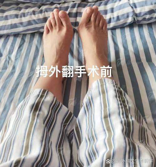 一、武汉中翰季官学医生做大脚骨矫正靠谱吗？