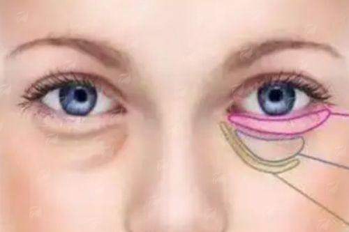 <strong>五、上海华美整形美容医院：术后管理五大关键点</strong>